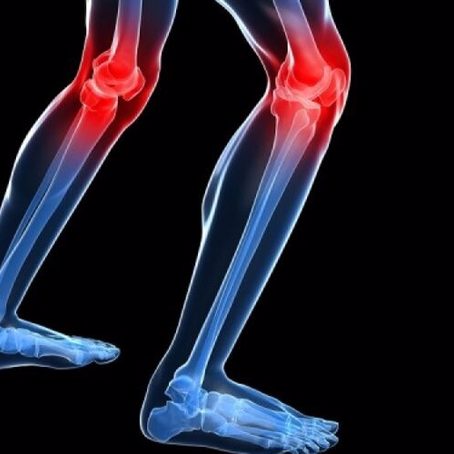 Αυχενικό σύνδρομο - αρθραλγίες και μυαλγίες